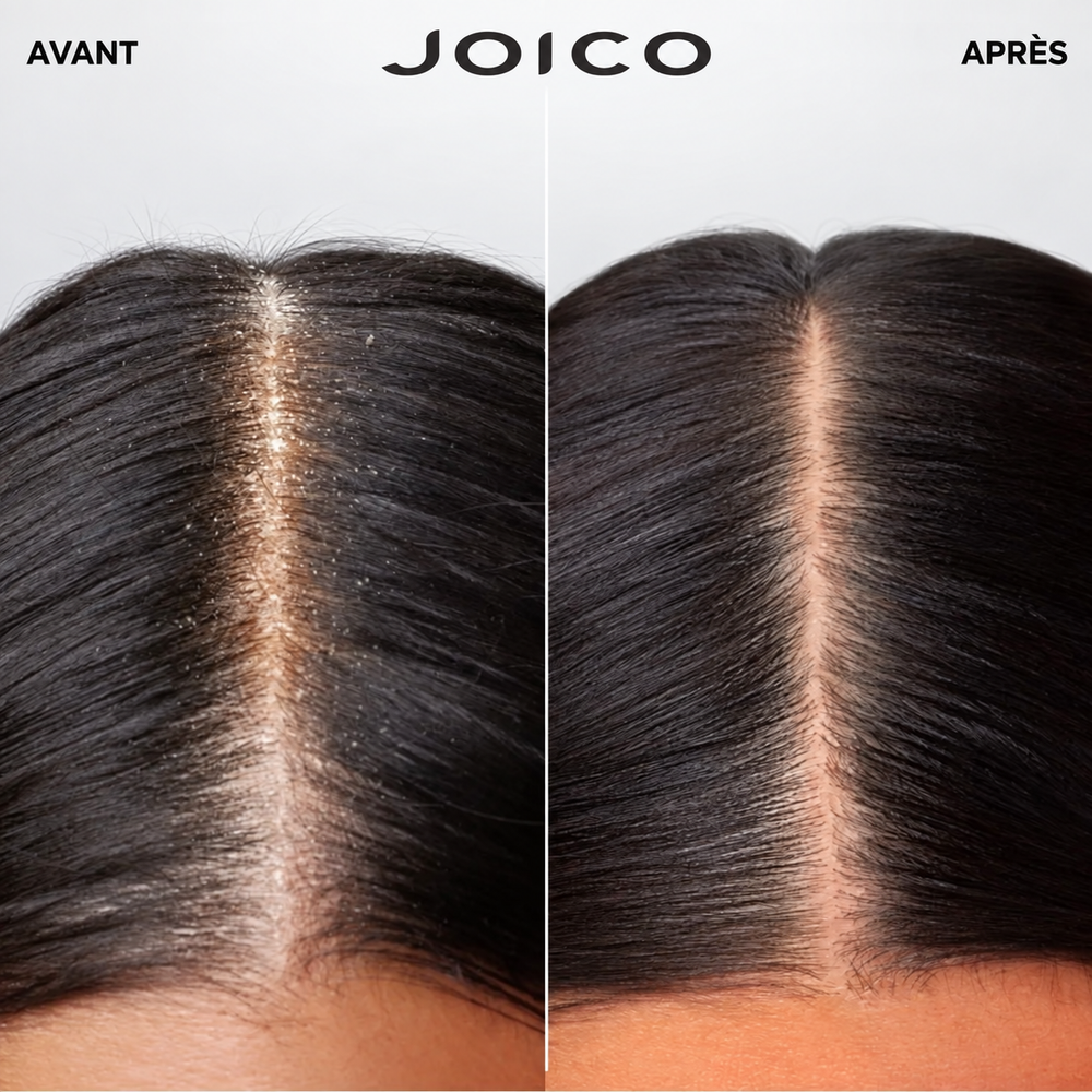 Gros plan avant et après Joico Scalp Vitality d’une raie sur cheveux brun foncé : à gauche, cuir chevelu et cheveux présentant de nombreuses particules blanches visibles; à droite, raie et racines d’apparence plus propres et sans particules visibles, sur fond blanc.