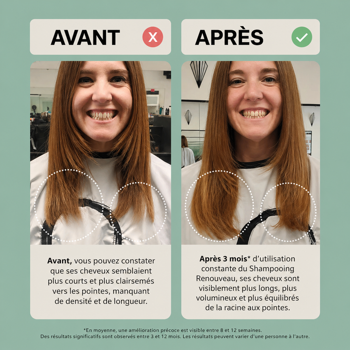 Résultat avant après sur femme aux cheveux roux après utilisation du shampoing ACT/IV Renouveau, montrant des cheveux plus longs, plus denses et plus volumineux après 3 mois.