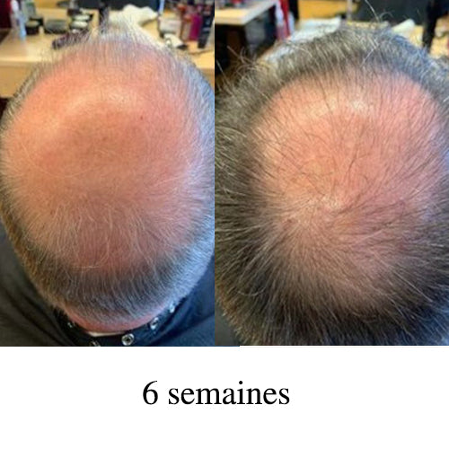 ACTIIV duo homme shampoing/revitalisant 473 ml