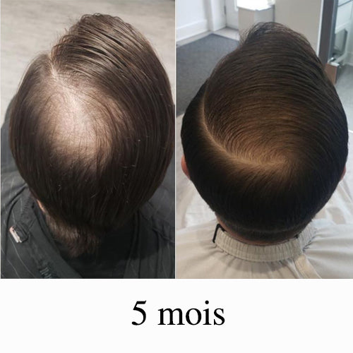 ACTIIV duo homme shampoing/revitalisant 473 ml