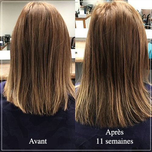 Actiiv après-shampoing soignant RENEW