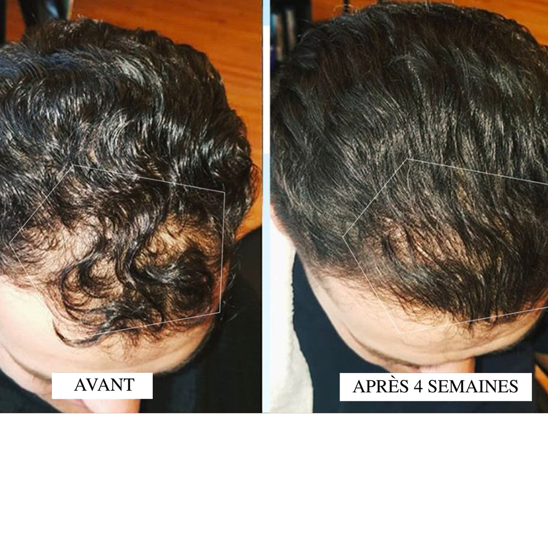 ACTIIV duo homme shampoing/revitalisant 473 ml