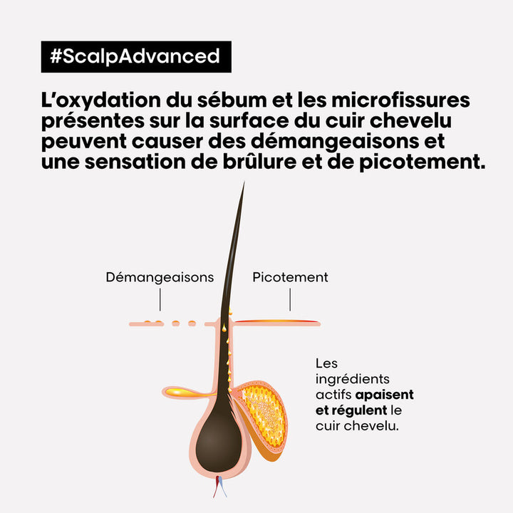 Illustration L’Oréal Professionnel Scalp Advanced montrant un follicule pileux, les démangeaisons, picotements et l’action apaisante sur le cuir chevelu.